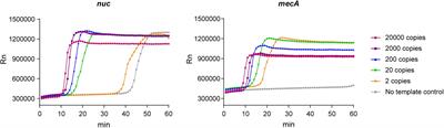 Combining CRISPR-Cas12a-Based Technology and Metagenomics Next Generation Sequencing: A New Paradigm for Rapid and Full-Scale Detection of Microbes in Infectious Diabetic Foot Samples